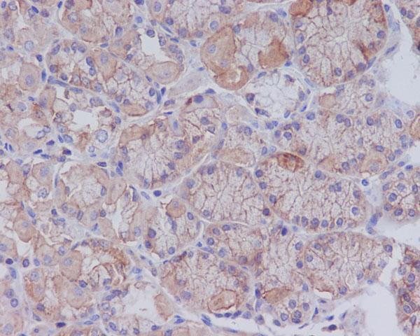 Anti-CD147 BSG Rabbit Monoclonal Antibody Boster Bio