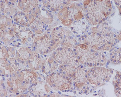 Anti-CD147 BSG Rabbit Monoclonal Antibody Boster Bio