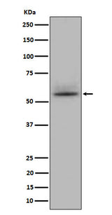 Anti-CD147 Rabbit Monoclonal Antibody Boster Bio