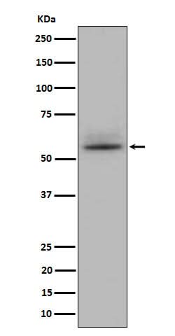 Anti-CD147 Rabbit Monoclonal Antibody Boster Bio