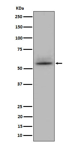 Anti-CD147 Rabbit Monoclonal Antibody Boster Bio