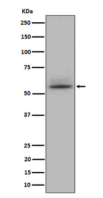 Anti-CD147 Rabbit Monoclonal Antibody Boster Bio