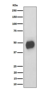Anti-CD147 Rabbit Monoclonal Antibody Boster Bio