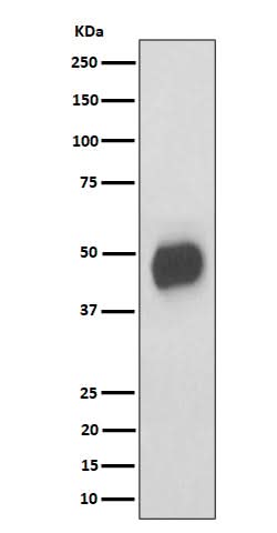 Anti-CD147 Rabbit Monoclonal Antibody Boster Bio
