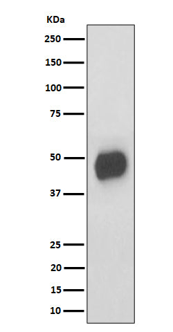 Anti-CD147 Rabbit Monoclonal Antibody Boster Bio