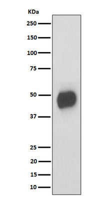 Anti-CD147 Rabbit Monoclonal Antibody Boster Bio