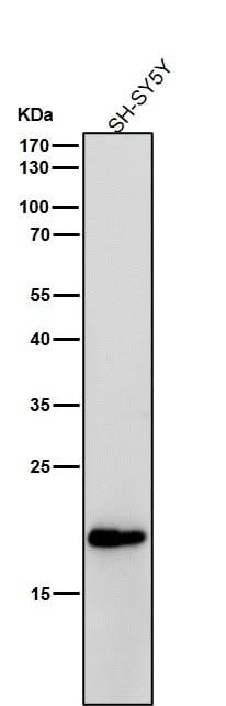 Anti-C Reactive Protein Rabbit Monoclonal Antibody Boster Bio