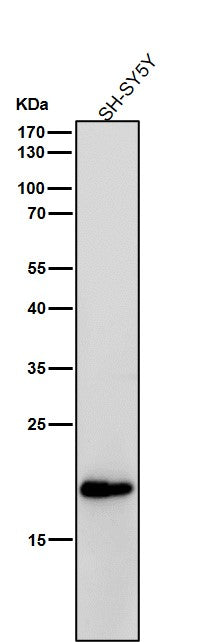 Anti-C Reactive Protein Rabbit Monoclonal Antibody Boster Bio