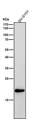 Anti-C Reactive Protein Rabbit Monoclonal Antibody Boster Bio