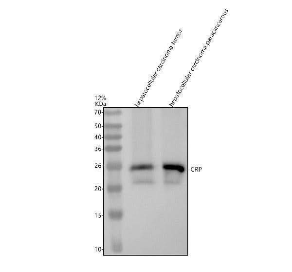 Anti-C Reactive Protein CRP Rabbit Monoclonal Antibody Boster Bio