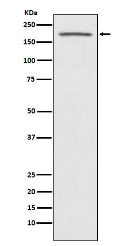Anti-ACE1 Monoclonal Antibody Boster Bio