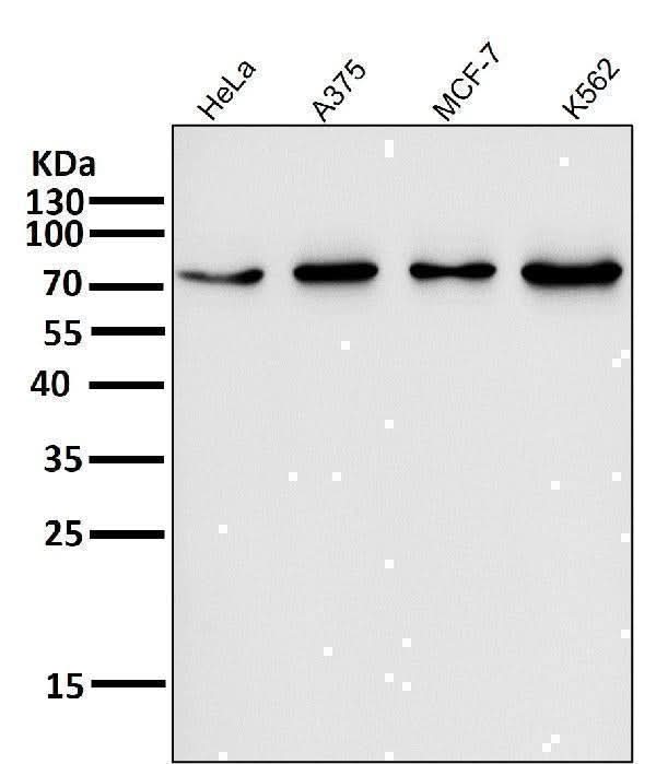 Anti-FoxO3a Rabbit Monoclonal Antibody Boster Bio