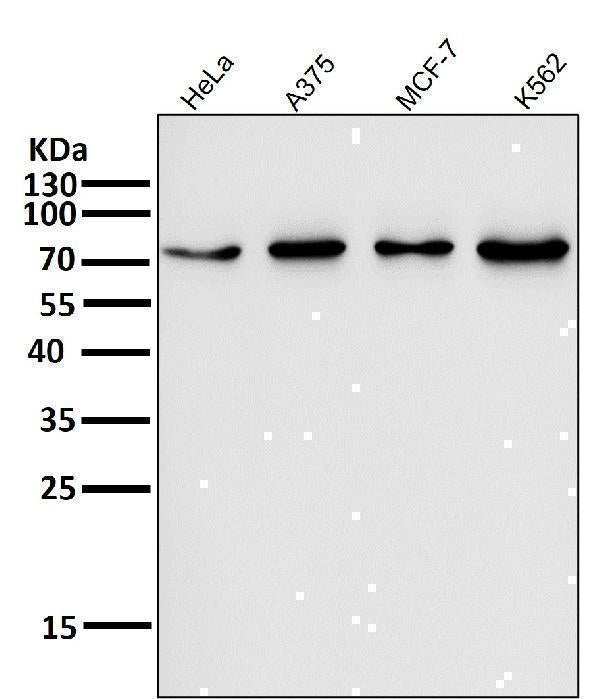 Anti-FoxO3a Rabbit Monoclonal Antibody Boster Bio