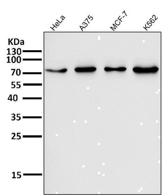 Anti-FoxO3a Rabbit Monoclonal Antibody Boster Bio
