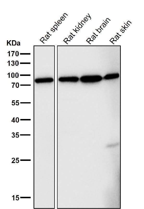 Anti-FoxO3a Rabbit Monoclonal Antibody Boster Bio