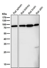 Anti-FoxO3a Rabbit Monoclonal Antibody Boster Bio