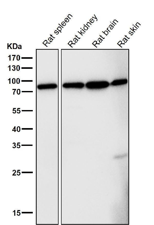 Anti-FoxO3a Rabbit Monoclonal Antibody Boster Bio