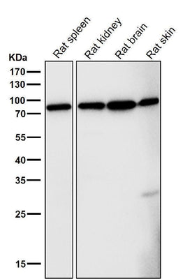 Anti-FoxO3a Rabbit Monoclonal Antibody Boster Bio