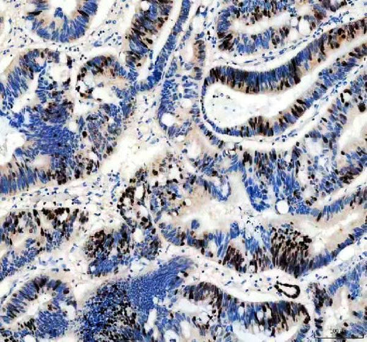 Anti-Ki67/MKI67 Rabbit Monoclonal Antibody Boster Bio
