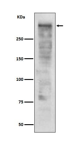 Anti-Ki67 MKI67 Rabbit Monoclonal Antibody Boster Bio