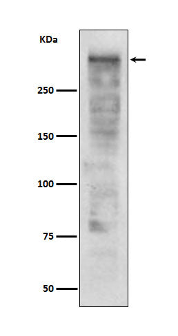 Anti-Ki67 MKI67 Rabbit Monoclonal Antibody Boster Bio