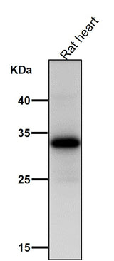 Anti-UCP1+UCP3 Rabbit Monoclonal Antibody Boster Bio