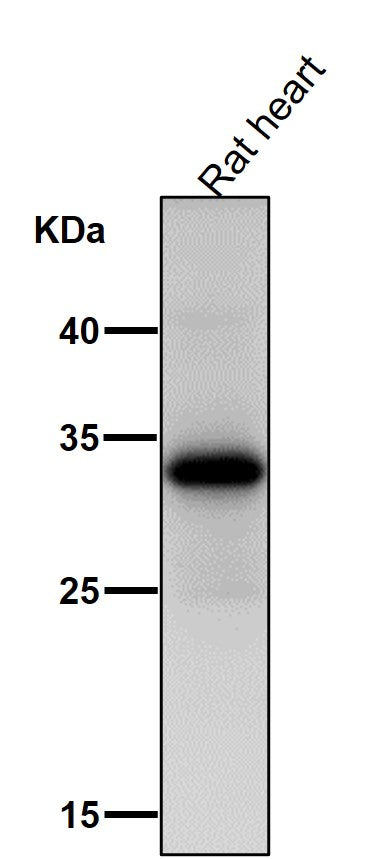 Anti-UCP1+UCP3 Rabbit Monoclonal Antibody Boster Bio