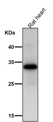 Anti-UCP1+UCP3 Rabbit Monoclonal Antibody Boster Bio