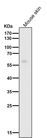 Anti-HDAC1 Rabbit Monoclonal Antibody Boster Bio