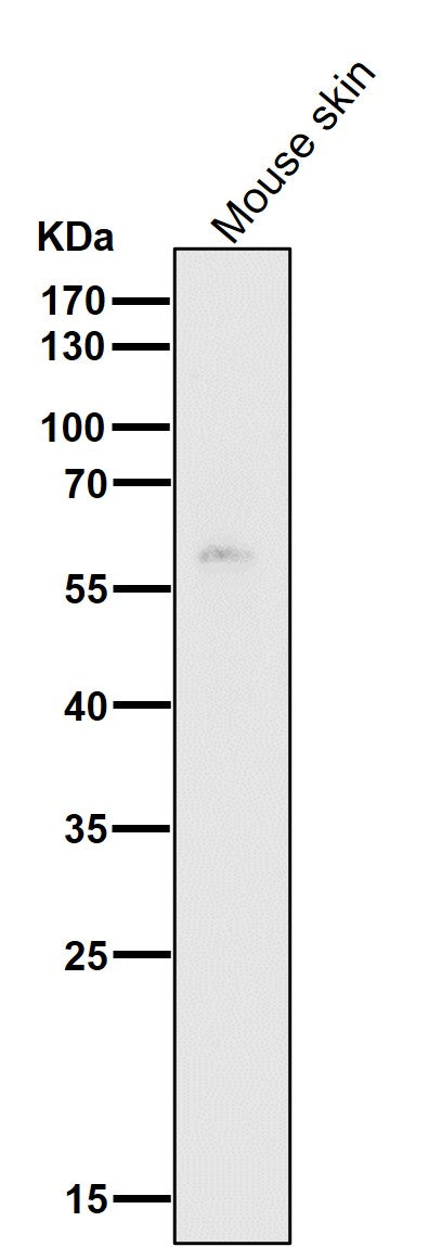 Anti-HDAC1 Rabbit Monoclonal Antibody Boster Bio