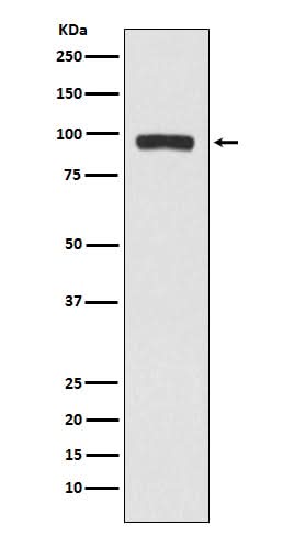 Anti-BCHE Rabbit Monoclonal Antibody Boster Bio