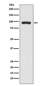 Anti-BCHE Rabbit Monoclonal Antibody Boster Bio