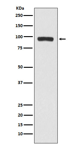 Anti-BCHE Rabbit Monoclonal Antibody Boster Bio