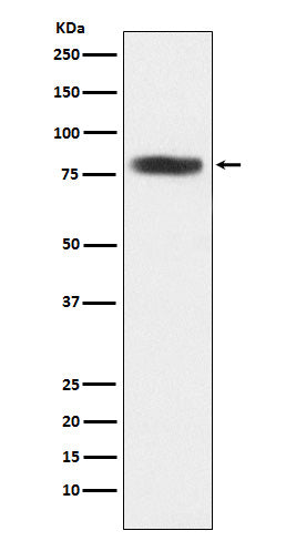 Anti-CARS Rabbit Monoclonal Antibody Boster Bio