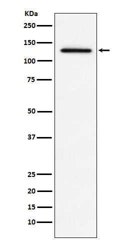 Anti-MDA5 Monoclonal Antibody Boster Bio