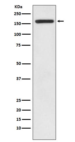Anti-IRS1 Rabbit Monoclonal Antibody Boster Bio