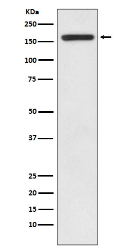 Anti-IRS1 Rabbit Monoclonal Antibody Boster Bio