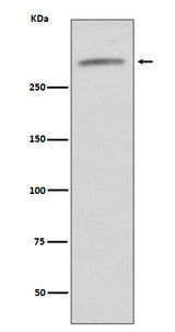 Anti-VWF/Von Willebrand Factor Rabbit Monoclonal Antibody Boster Bio