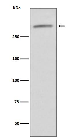 Anti-VWF/Von Willebrand Factor Rabbit Monoclonal Antibody Boster Bio