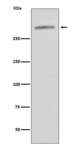 Anti-VWF/Von Willebrand Factor Rabbit Monoclonal Antibody Boster Bio
