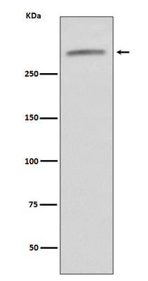 Anti-VWF/Von Willebrand Factor Rabbit Monoclonal Antibody Boster Bio
