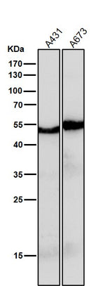 Anti-PAX6 Rabbit Monoclonal Antibody Boster Bio