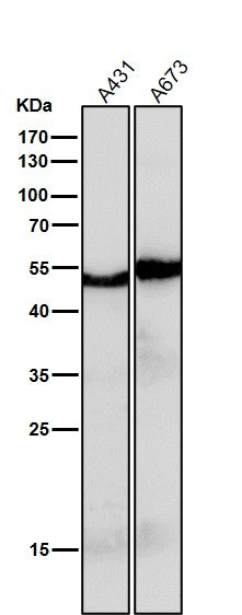 Anti-PAX6 Rabbit Monoclonal Antibody Boster Bio
