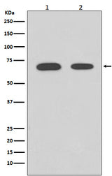 Anti-Chk2 CHEK2 Rabbit Monoclonal Antibody Boster Bio