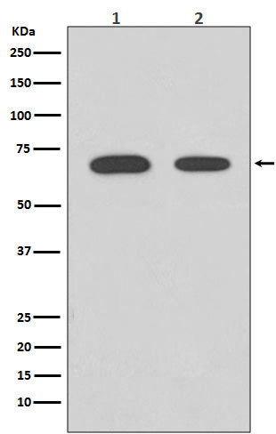 Anti-Chk2 CHEK2 Rabbit Monoclonal Antibody Boster Bio