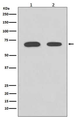 Anti-Chk2 CHEK2 Rabbit Monoclonal Antibody Boster Bio
