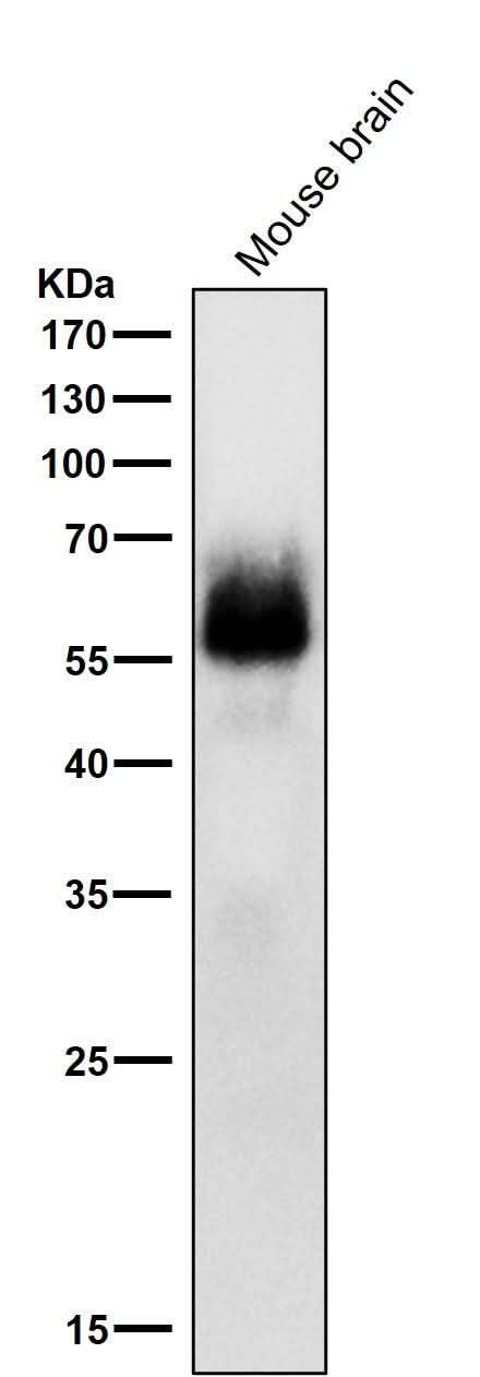 Anti-Phospho-Chk2 (S33 + S35) Rabbit Monoclonal Antibody Boster Bio