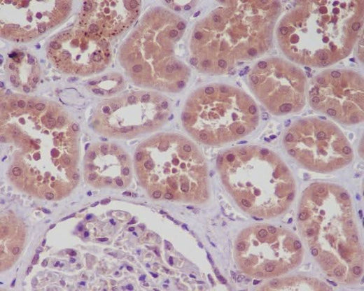 Anti-NF-Kappa B (p105/p50) NFKB1 Rabbit Monoclonal Antibody Boster Bio