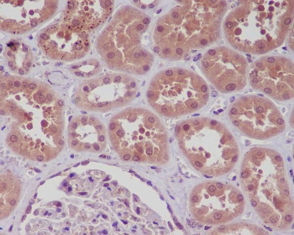 Anti-NF-Kappa B (p105/p50) NFKB1 Rabbit Monoclonal Antibody Boster Bio