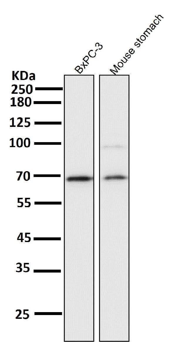 Anti-NF-Kappa B p65 RELA Rabbit Monoclonal Antibody Boster Bio
